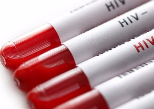 Phát hiện thuốc điều trị ung thư phổi có thể tiêu diệt các tế bào HIV