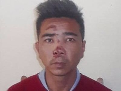 Đâm người tình bằng dao gọt hoa quả vì ghen tuông