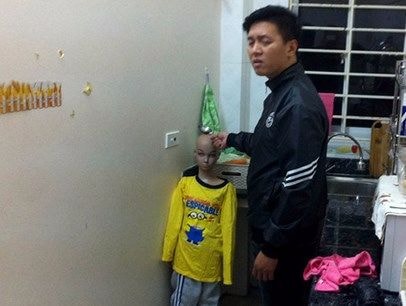 Ở với bố và mẹ kế, cháu bé 10 tuổi liên tục bị hành hạ dã man