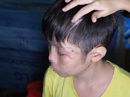 Cuộc sống đọa đầy của bé trai 10 tuổi khi ở cùng bố và mẹ kế