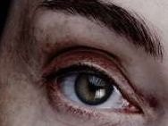 Đôi mắt tiết lộ điều gì về sức khỏe của bạn?