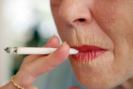 Hút thuốc lá ảnh hưởng xấu đến dung mạo