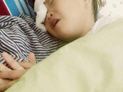 Bé gái 2 tuổi ở Nghệ An bị gà chọi mổ mù một mắt