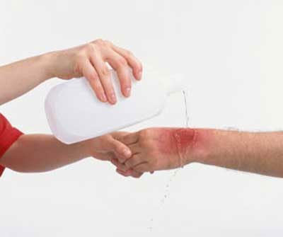 Tại sao vết thương của bạn lâu lành hơn những người khác