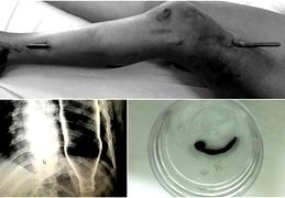 Những ca bệnh hy hữu được giải cứu thành công