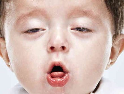 Bé 2 tháng tuổi tử vong sau khi cha mẹ tự chữa ho tại nhà