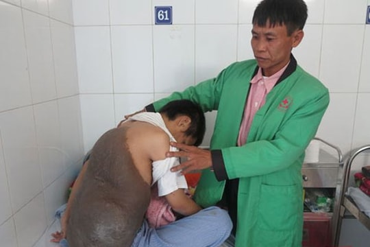 Chàng trai cõng mai rùa khổng lồ, 26 năm ngủ ngồi