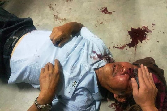 Truy bắt bảo vệ chung cư đánh cụ ông 68 tuổi nhập viện