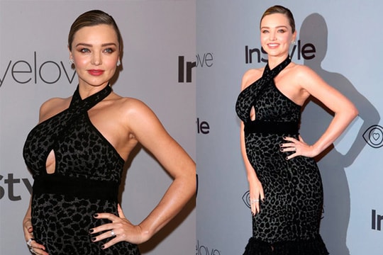 Miranda Kerr bụng bầu vẫn sexy, diện giày cao gót dự tiệc Quả cầu vàng