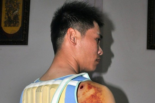 Bắt con trai bí thư xã đánh trọng thương người cãi nhau với bố