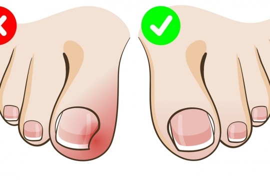 Đừng chủ quan, dù đó là cắt móng chân