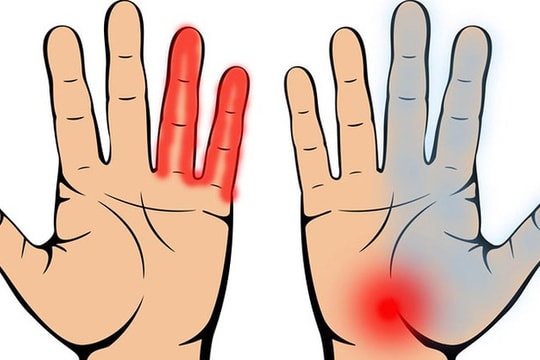 8 dấu hiệu không ngờ của ung thư phổi