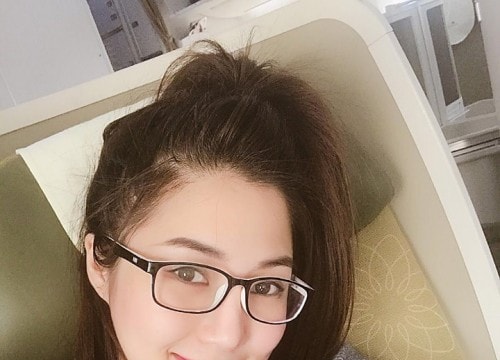 Hương Tràm bị viêm kết mạc sâu vì lạm dụng kính áp tròng