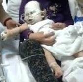 Bé 6 tháng tuổi nguy kịch vì bị máy sưởi đổ lên người