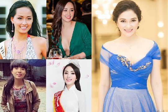 Lộ hình ảnh sau khi 'mài răng, căng da' của các Hoa hậu