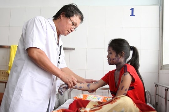 Miền Bắc đang bước vào đợt cao điểm của dịch thủy đậu