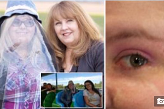 Bệnh lạ: Cô gái sống kiểu 'ma ca rồng'