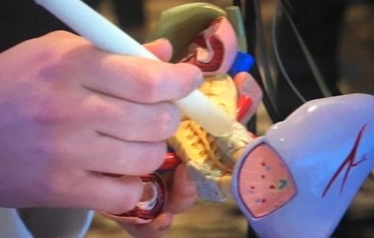 Bút phát hiện ra bệnh ung thư trong chỉ 20 giây