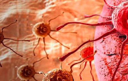 Phát hiện bộ phận mới trong cơ thể người liên quan đến ung thư