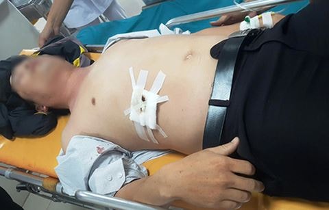 Nhắc nhở xóa hình xăm, thầy giáo bị học sinh đâm thủng gan