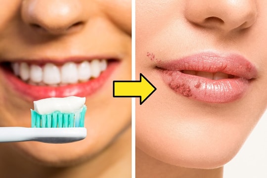10 mẹo làm đẹp truyền miệng lợi bất cập hại