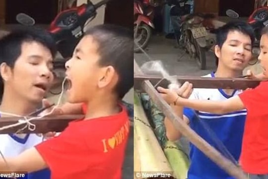 Clip cậu bé Việt Nam nhổ răng bằng nỏ lên báo Anh