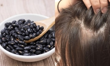 3 cách trị tóc bạc sớm không thể bỏ qua