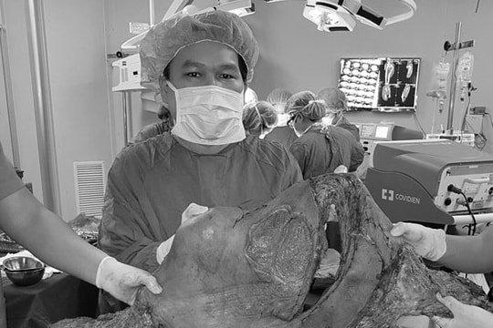 Phẫu thuật cắt khối u 45kg cho chàng trai phải bò trên đường