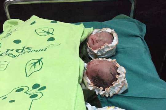 Người mẹ trẻ ở Thanh Chương vượt cạn, sinh 3 bé gái