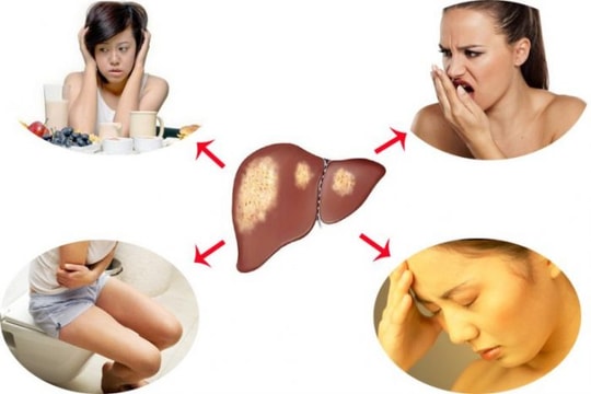 6 dấu hiệu cảnh báo gan chứa đầy độc tố