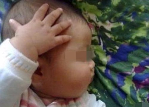 Bé thường xuyên cào tay lên đầu và tai, bố mẹ không nên xem nhẹ