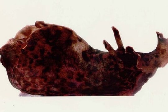 ‘Cấy ghép trí nhớ’ thành công cho ốc sên