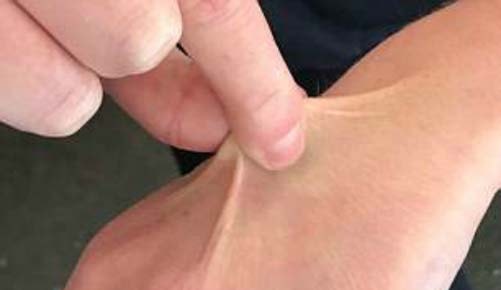 3 giây kiểm tra cơ thể bạn đủ nước hay không