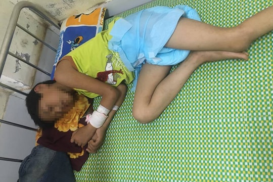 Bé trai 11 tuổi bị tổn thương não nghiêm trọng  vì uống 1 lít rượu
