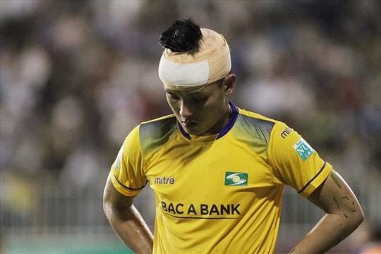 Trung vệ SLNA phải khâu 15 mũi sau cú va chạm với cầu thủ HAGL