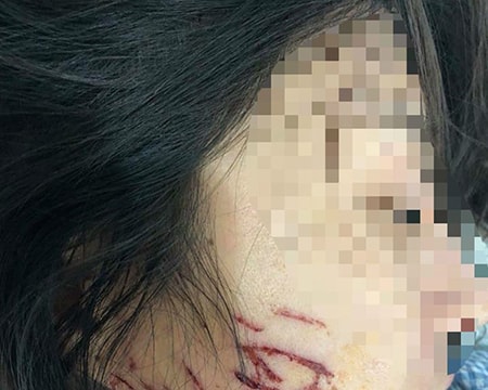 3 phụ nữ bị khởi tố vì đánh ghen, lột đồ chủ tiệm spa