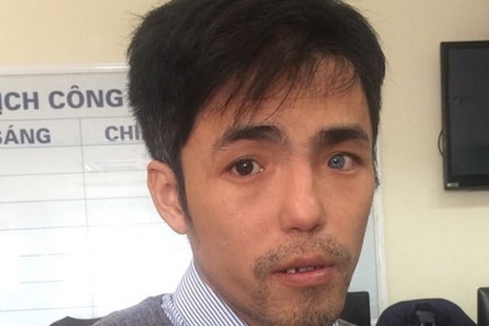 Kẻ biến dị đóng mác Việt kiều ra những cú lừa...siêu dị 