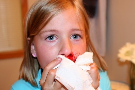 Nắng nóng, chảy máu cam ở trẻ nhỏ có thể dẫn tới tử vong