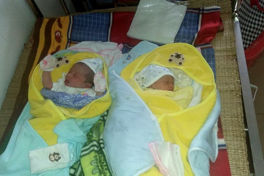 Nghệ An mổ thành công ca song thai còn nguyên bọc ối hiếm gặp