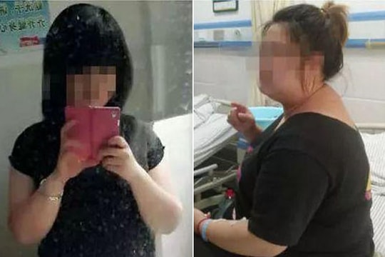 Hoảng hồn uống thuốc giảm cân 7 năm, cô gái tăng cân gấp đôi