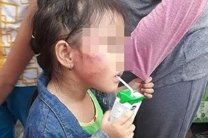 Bắt bảo mẫu bạo hành gái 5 tuổi trong cơ sở mầm non 