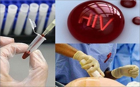 Những dấu hiệu bị nhiễm HIV
