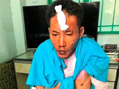 Mâu thuẫn với tình cũ, gã đàn ông mang xăng đốt cả 3 mẹ con