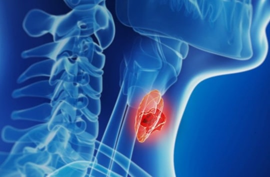 10 loại ung thư thường gặp ở người trẻ tuổi