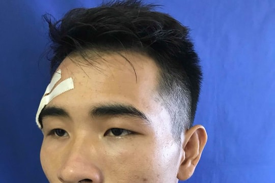 Khởi tố đối tượng gây ra 3 vụ trộm, cướp điện thoại của người dân