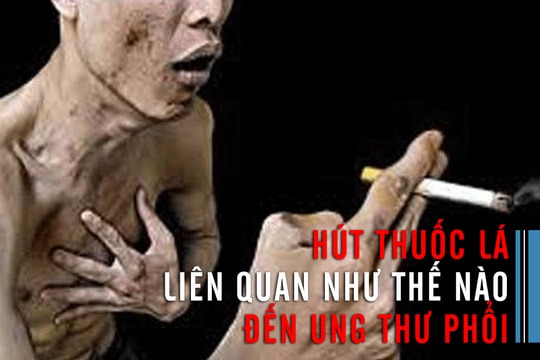 Hút thuốc lá liên quan như thế nào đến ung thư phổi?