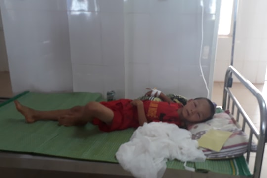 Bé trai lớp 3 bị ong vò vẽ đốt nhập viện cấp cứu