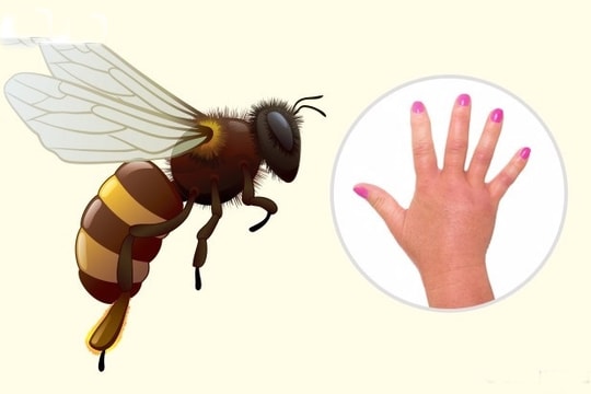 Mẹo “nhận dạng” đơn giản vết cắn do côn trùng