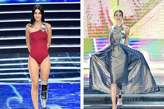 Nghị lực đáng khâm phục của cô gái khuyết tật giành Á hậu Ý