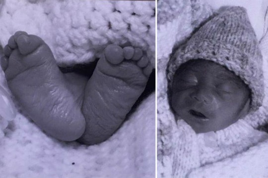 Bác sĩ nói phá thai thành công, bé vẫn chào đời